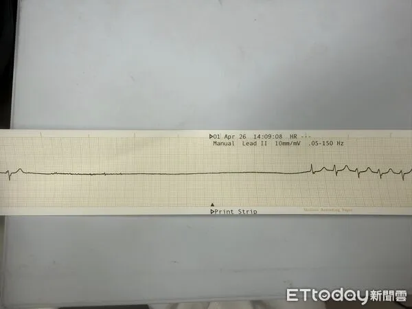 ▲▼「他會突然死掉！」急診醫想移床被攔　看監視器嚇瘋：心跳按暫停。（圖／粉專「急診碎碎念」授權提供）
