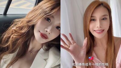 艾莉絲近照「遭指感覺不一樣」　釣出本人揭真相：沒有用濾鏡