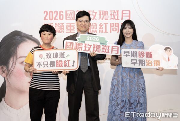 玫瑰斑記者會。（圖／記者趙于婷攝）
