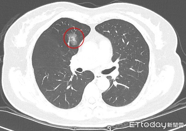 ▲▼    台北慈院         。（圖／台北慈院提供）