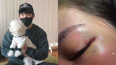 Jisoo親哥妻崩潰出面！全身傷家暴照曝光：逼迫吞X、強硬從後面來