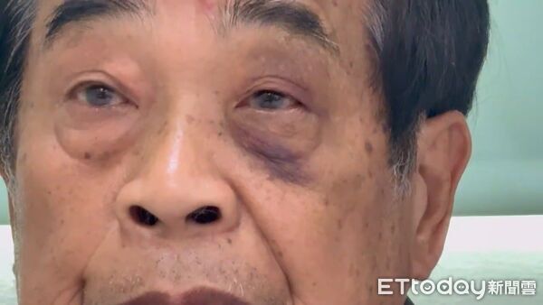 ▲▼ 林一民遭攻擊 。（圖／記者游瓊華翻攝）