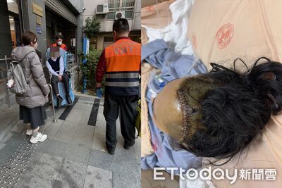 男路倒遭警認定酒駕扣留　中風腦出血+積水...晚3小時送醫險害命