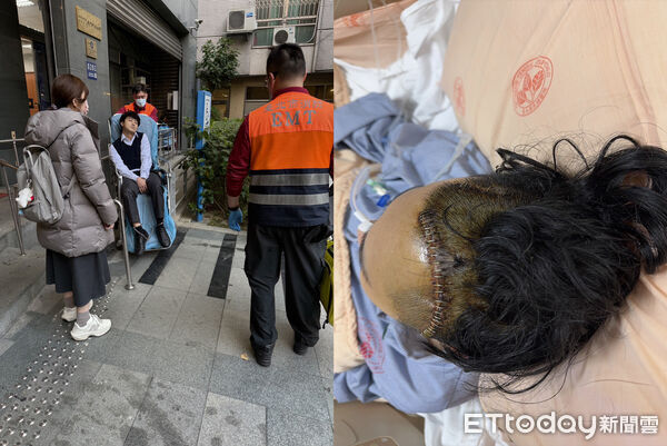 ▲杜男騎車中風遭萬華警員誤認酒駕、延遲送醫3小時緊急開腦手術才救回一命。（圖／記者張君豪翻攝）