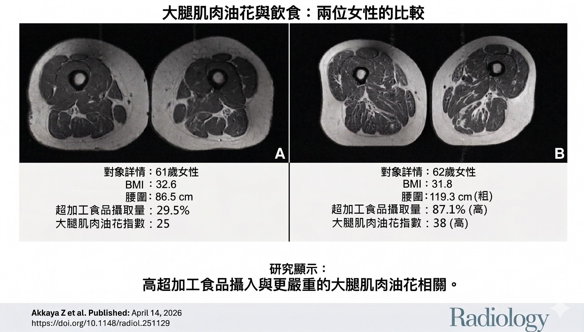 ▲愛吃超加工食品「大腿變A5和牛」！　研究震撼圖曝光。(圖／取自蔡明劼醫師粉專)