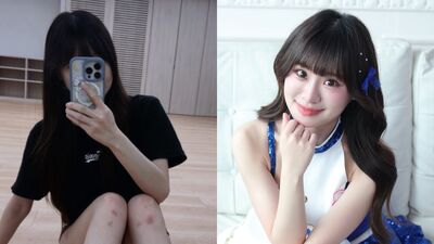 富邦啦啦隊女神「膝蓋韌帶撕裂」　PO傷勢照崩潰喊：我的天！