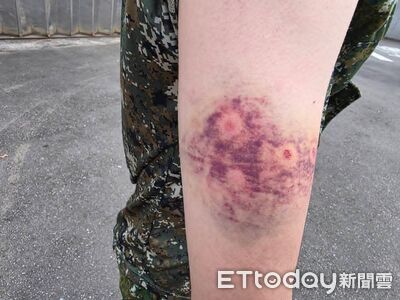 顧立雄剛震怒完！陸軍學員遭教官「連開8槍」傷勢超可怕