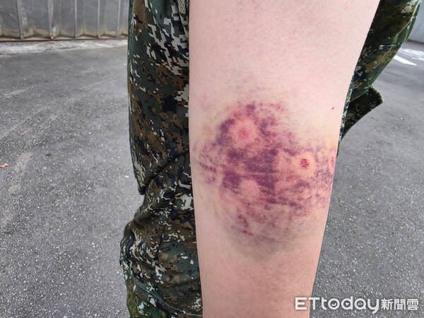 顧立雄剛震怒完！陸軍學員遭教官「連開8槍」傷勢超可怕