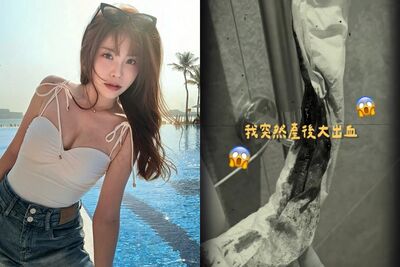 瑀熙「產後大出血」掛急診！　服杜仲丸血流不止驚：好險還活著