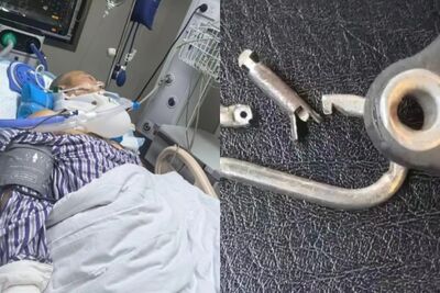 鎖扣突斷裂！60歲健身男遭划船機彈飛慘致「癱瘓」…妻崩潰
