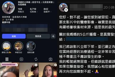 台大神婆出事了！「母5kg腫瘤消失」被控盜圖　急刪片道歉