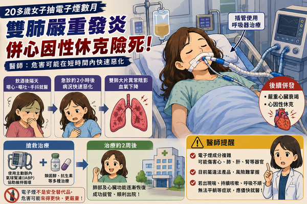 ▲▼        電子煙     。（AI協作圖／記者邱俊吉製作，經編輯審核）