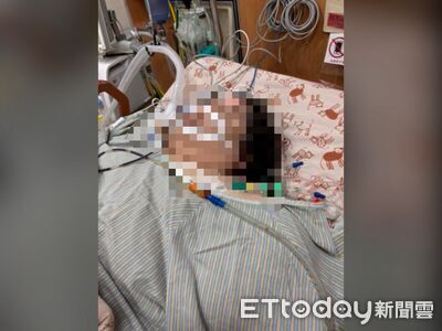 名醫又出事！前舉重國手減重手術大失血　狂輸1萬c.c搶命救不回