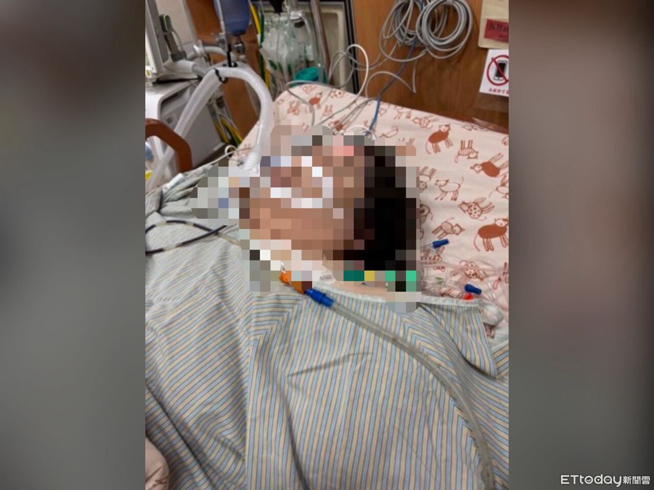 名醫又出事!前舉重國手減重手術大失血 狂輸1萬c.c搶命救不回