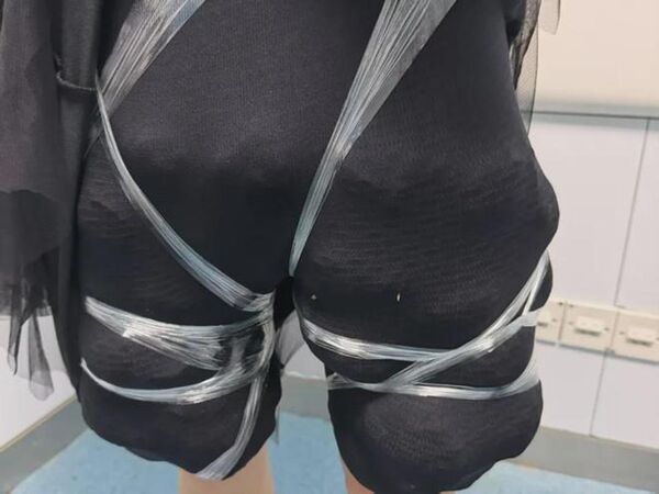 她穿長裙「下體異樣狂晃」...海關一靠近聞腥臭味　雙腿竟綁58隻活陸龜！密密麻麻超噁畫面曝