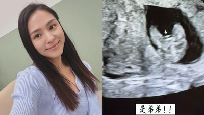 熊熊曬超音波揭曉二寶性別！　產檢被醫讚：走路有風喔