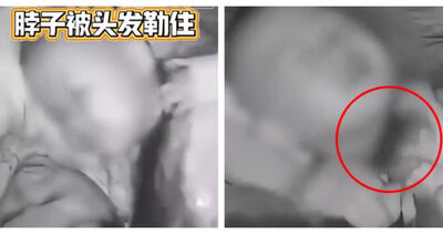 睡夢中被媽媽長髮勒頸！她驚醒見2歲兒痛苦掙扎...急徒手斷髮救命