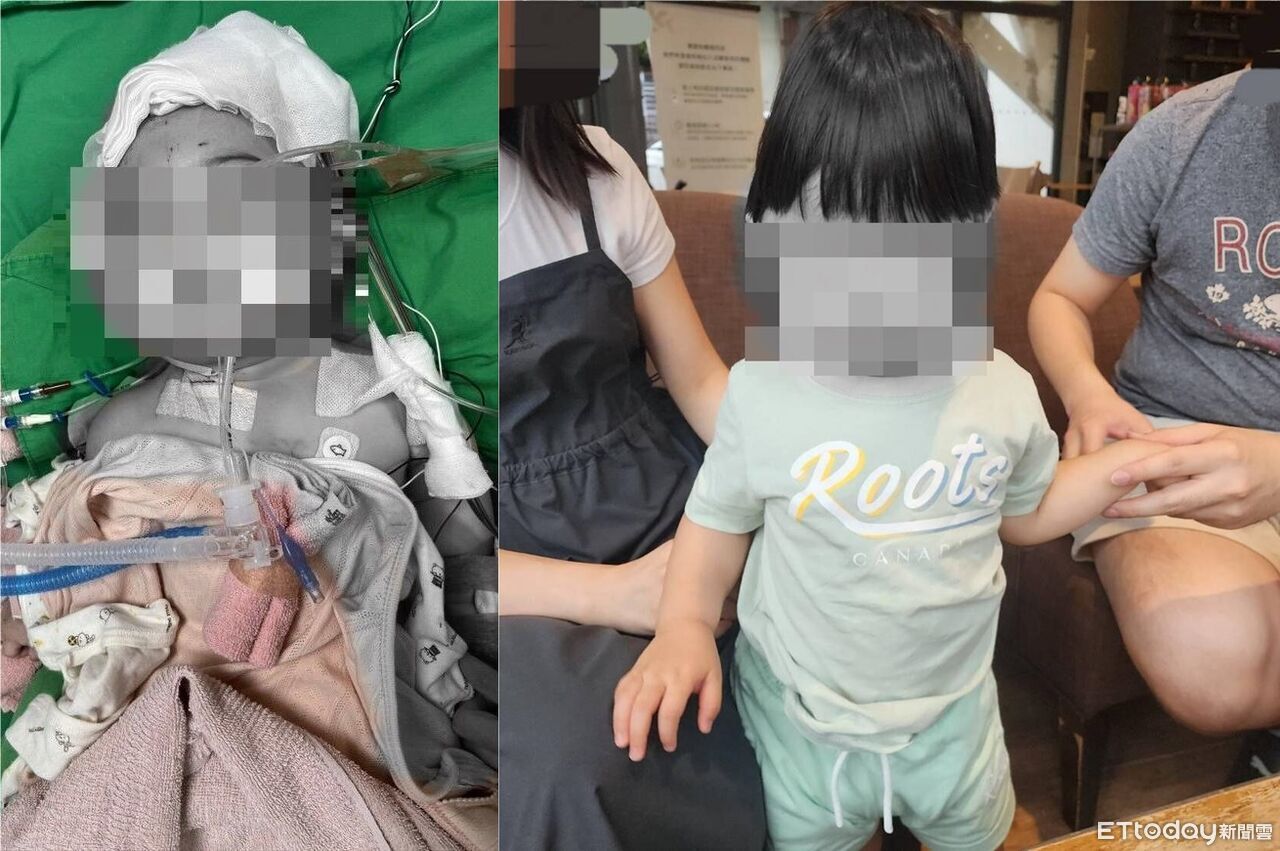 獨/女嬰托育竟腦重創「5度開顱」 保母測謊未過卻獲不起訴