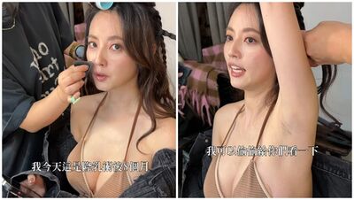 阿諾隆乳8個月「真實罩杯全說了」！羞露傷口…認：還做縮乳頭手術