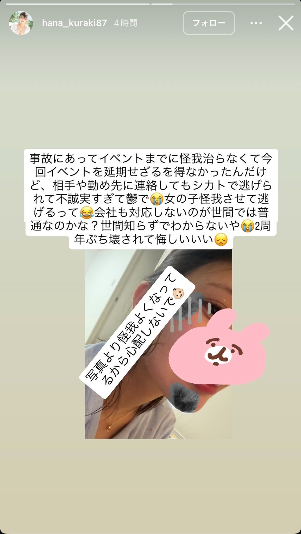 ▲▼女優倉木華驚傳車禍「顴骨下巴爆血」。（圖／翻攝自X）