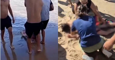 19歲女海灘玩水　遭鯊魚攻擊「右腿當場被咬斷」