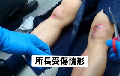 快訊／毒駕男輾斷所長雙腿！聲押竟獲法官請回...檢方火速抗告