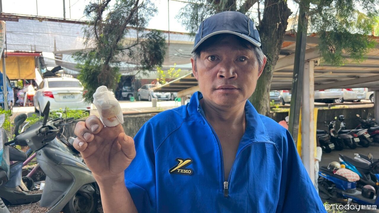 遭塔塔加薊刺傷3週險釀敗血症 幸遇玉山醫療隊診治逃過劫數