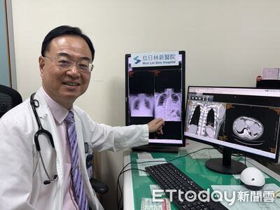 男胸痛就醫「1天半惡化成罕見膿胸」　竟是口腔細菌吸入釀禍
