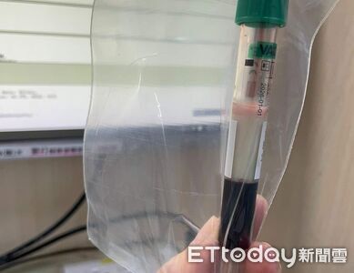 26歲女急診抽出「半管漂浮奶昔」！數值飆破千　醫嘆：愛吃甜也中