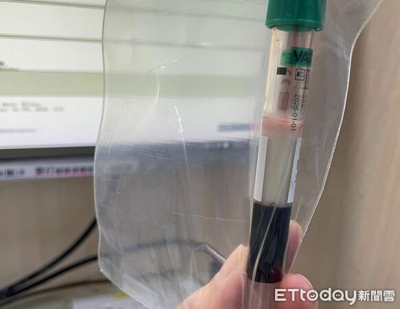 ▲▼26歲女急診抽出「半管漂浮奶昔」！數值飆破千　醫嘆：愛吃甜也中。(圖／貝琪梨醫師授權提供，未經同意請勿任意翻攝）
