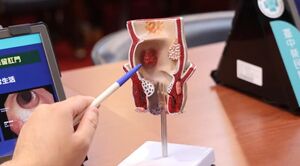 40歲男罹大腸癌3期「恐切肛門」　中榮TNT新療法「保肛成功」