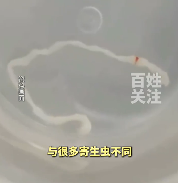 ▲活蟲原因與王太太平時在家料理習慣有關。（示意圖／翻攝自微博）