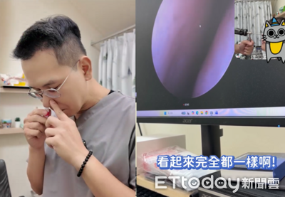 鼻塞一吸秒通？醫實測「泰國薄荷棒」　一照內視鏡驚喊：假的啦