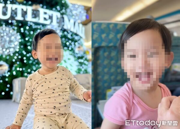 ▲滾燙咖啡潑全身！1歲半嬰「皮片片剝落」 母崩潰：每天像在地獄。（圖／男嬰母親李小姐授權提供，未經同意請勿任意翻攝）