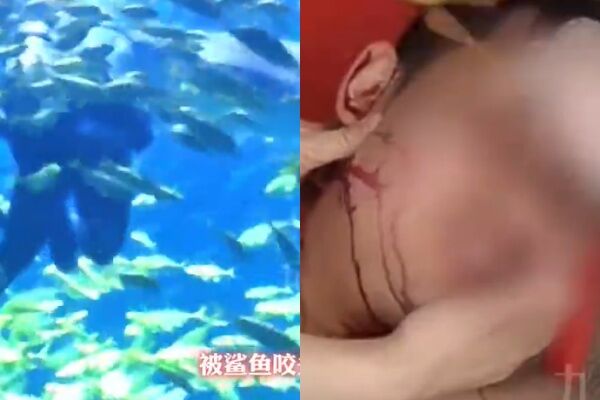 未告知!陸男潛水「遭鯊魚咬頭」頭破血流 員工還問要不要繼續 | ETtoday大陸新聞 | ETtoday新聞雲