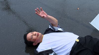 男星拍八點檔濃縮血漿噴入鼻腔！遭貨車撞擊「瘋狂吐血」 生死未卜