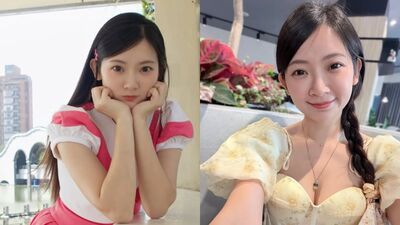 優格姐姐蕁麻疹發作「腫到吞嚥困難」　心慌求解：萬念俱灰的感覺