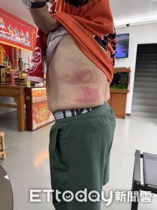台南豪雨淹水人孔蓋噴開!議員勘災跌落箱涵 全身是傷險滅頂