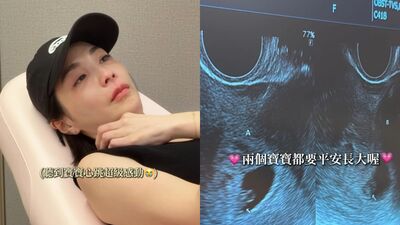 湘瑩懷雙胞胎聽心跳哭了! 感動喊:原來這就是幸福的聲音