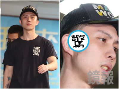 孫安佐太陽穴旁驚見「大面積傷痕」 本人冷回一句
