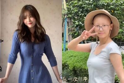 陸「藍衣女戰神」剃頭抗癌6個月　曝將最後化療：馬上要熬出頭了