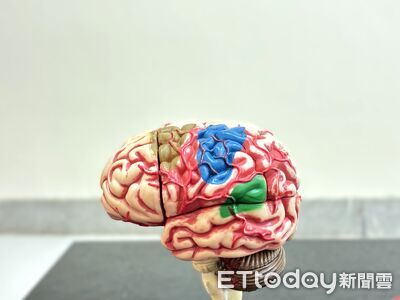 「明星益生菌」可護腦！研究：59種腸道菌與阿茲海默症有關