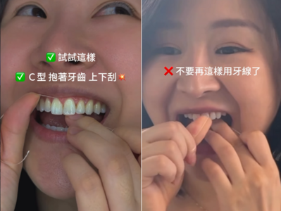 牙線不是剔菜渣!醫教「C字刮法」除牙菌斑:流血更要清