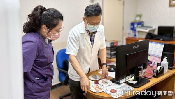 ▲▼5類食品含反式脂肪，醫生建議避免食用以維護心血管健康。（圖／玉里醫院提供，下同）