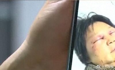 媳婦打斷婆婆肋骨! 兒竟嗆母「有錯在先」:顧談戀愛不帶小孩
