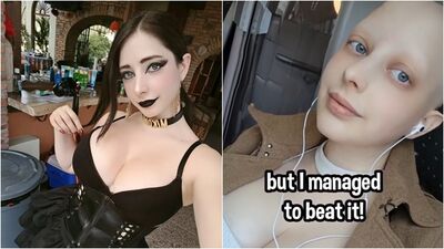 拍A片被摸出「胸部有腫塊」　OnlyFans女模確診乳癌：救我一命
