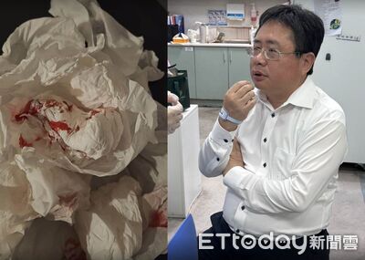 矢板明夫遭中國人士痛毆 民進黨:暴力侵犯言論自由為民主社會所不容