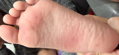 宜蘭童玩節爆安全危機!戲水池掉漆飄水面...高地板木刺多人傷