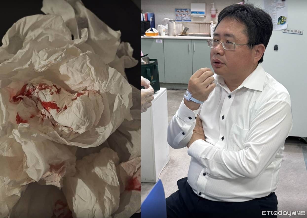 矢板明夫台中演講被打滿嘴血 盧秀燕嚴正回應:台中不允許暴力 | ETtoday社會新聞 | ETtoday新聞雲