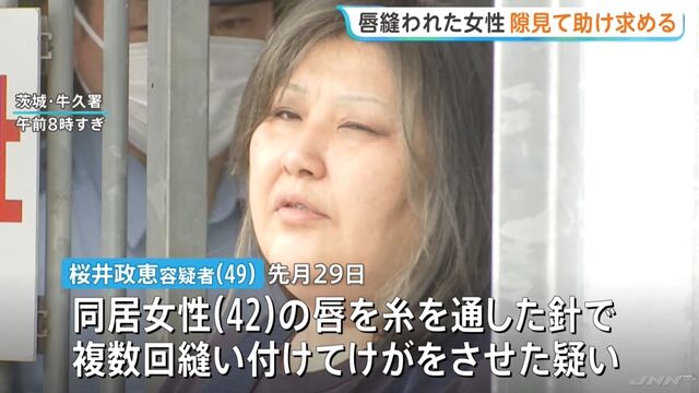 嘴巴遭針線縫合!日女逃離「恐怖同居女」 顫抖遞紙條:救救我 | ETtoday國際新聞 | ETtoday新聞雲